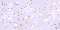 Glitter -  154 hits